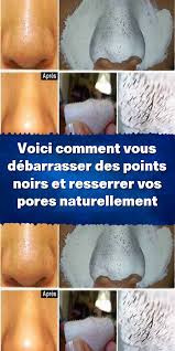 Epingle Sur Astuces Beaute Naturelle