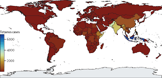 Image result for Tetanus