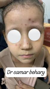 د. سمر محسن...