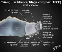 Radioulnaria direkt vom kortex des radius. Triangular Fibrocartilage Complex Radiology Reference Article Radiopaedia Org