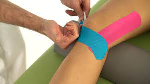 Komplette anleitung zum tapen des kniegelenks. Theramaid Tapeanleitung Knie Seitenband Innenband Premium Kinesiotape Lauferknie Plica Syndrom Youtube