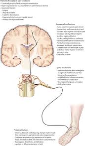 Pain is a distressing feeling often caused by intense or damaging stimuli. Nociplastic Pain Towards An Understanding Of Prevalent Pain Conditions The Lancet