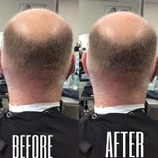 Here's another timeless scissor cut that can also benefit men with receding hairlines or thinning hair. Pin On Men S Haircuts