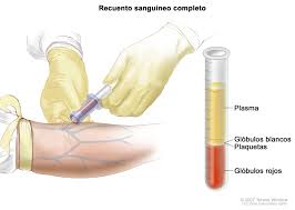 Tratamiento De La Leucemia Mieloide Aguda Pdq Version Para Pacientes Instituto Nacional Del Cancer