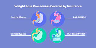 West medical does not intend for content found on this site to be considered medical advice. Weight Loss Surgery Insurance Secrets Revised List