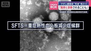 Yahoo!ニュース - News update
