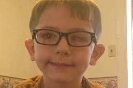 Fundraiser by Amanda Brandon Justus : Prosthesis Eye For Braxton Justus