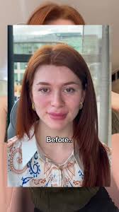 Antonia Higham Before and After