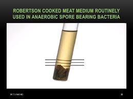 Maybe you would like to learn more about one of these? Ppt Bacterial Culture Methods Basics Powerpoint Presentation Free Download Id 2157627