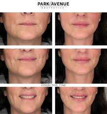 Christine Bateman, MSN, FNP-BC (@injector_tine) • Instagram photos and  videos