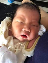 Singapore Family Battles Rare 'Maple Syrup Urine Disease'