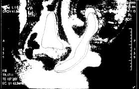 MRI third session (rear entry position ) | Download Scientific Diagram