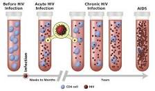 Image result for what course hiv