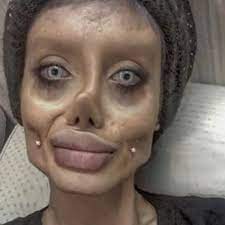 Unfortunately, accidents, age or genes can lead to a loss of full or partial vision, leaving us with a foggy or blurred vie. Sahar Tabar Iran Instagram Star Known For Plastic Surgery Arrested For Blasphemy Iran The Guardian