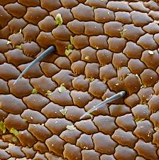 Image result for pubic lice symptoms