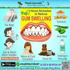 Top 7 Home Remedies To Reduce Gum Swelling Turmeric Aleovera Hydrogenpreoxide Cloveoil Warm Coldcompress Swollen Gums Remedy Swollen Gum Gum Health