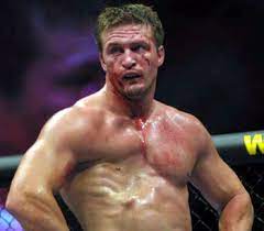 Is Anyone Else Out There Missing One Of Their Pectoral Muscles Or Am I The Only One Wtf