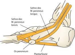The sinus tarsi syndrome was first described in the medical literature in 1958.1 overall incidence is unknown, but it is generally considered uncommon and without consistent gender predilection.2,3. Painful Os Peroneum Syndrom Pops Sciencedirect