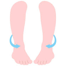 Image result for In-Toeing