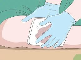 A tourniquet can be left on for up to 4 hours before risking permanent damage, if removed in a hospital setting. How To Apply A Tourniquet 9 Steps With Pictures Wikihow