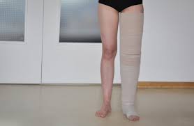 Lymphodem Blog Selbstbandagierung Bandage