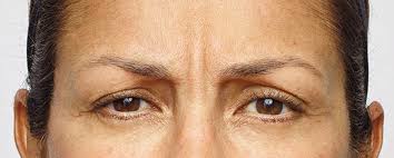 It takes tom 20 minutes to get to work in the morning. Botox And Dysport Spa 35