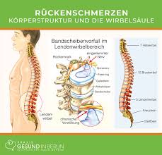 Ruckenschmerzen Naturheilpraxis Gesund In Berlin