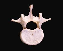 Image result for Lumbar vertebrae