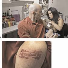 I understand the mechanics by it, but wondering what's the point in using it if your skin will return back to normal after the discontinuation of the cream? A The First Freedom 2 Tattoo Is Being Placed In The Arm Of The Ceo Of Download Scientific Diagram