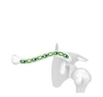 Superior Anterior Clavicle Locking Plate Ⅱ,Medical Device ...