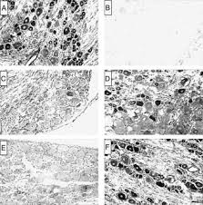 Back to 20 label an animal cell worksheet. Immunohistochemical Peroxidase Diaminobenzidine Analysis Of Nansns2 Download Scientific Diagram