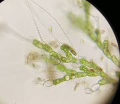 Image result for Bulbostylis megastachys