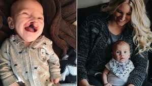 Segunda causa de muerte en los niños menores de 5 años