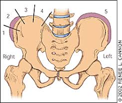 Image result for Risser Sign