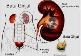 Maybe you would like to learn more about one of these? Penyebab Penyakit Lambung Menurut Ustad Danu Hidup Sehat