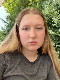 Anyone subleasing 1b1b units at Accolade?