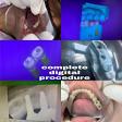 Dental Implants in Best Dental Clinic in Dwarka Sector 7 product image