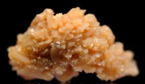 What Causes Kidney Stones