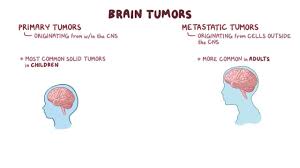 Brain cancer symptoms vary depending on the type, extent and location of the tumor, as well as the patient's age and healthy history, and often mimic those caused by other medical conditions, so it's important to consult a medical professional for an accurate. Brain Tumors Clinical Practice Osmosis