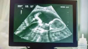 Dalam mendidik anak tugas keluarga sudah sangat berat, oleh karena itu harus dibantu oleh sekolah. Ternyata Begini Cara Bayi Bernapas Di Dalam Kandungan