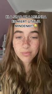 🤌 #melinda #foryouba #fyp #fy #viral