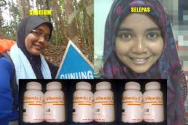 Vitamin c keluaran pahang pharma ini juga berupaya merawat masalah seperti meningkatkan tahap immune badan, mengurangkan gejala selsema, mempercepatkan pemulihan luka, sihatkan gusi, merawat asma dan elergi. Vitamin C 1000mg Pahang Pharma Original Murah Berkesan Tiptop Original Murah