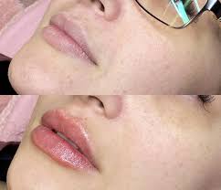 wrapped in a bow #fireworks #lanadelrey #bow