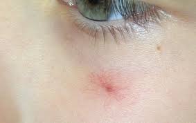 Just noticed tiny red dots (not bumps). 20 Common Causes Of Small Red Dots On Skin