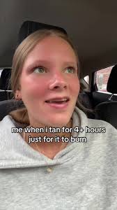 Burning When Tanning