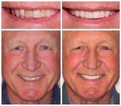 Meet Dr Tyler Broadbent