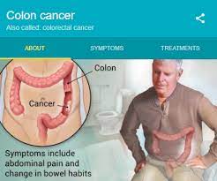 It's very important to know them, in order to detect them as soon as possible. Colon Cancer Polyps The Main Precursors Best Hindi Shayari Love Quotes Sms Messages For Love Sad Flirting And Cheating