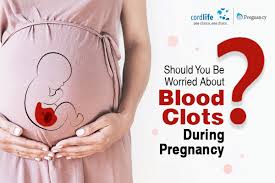 Blood clot during pregnancy find out why dangerous blood clots are more common during pregnancy how to prevent them and safe ways to treat them if you do. Should You Be Worried About Blood Clots During Pregnancy Cordconnect Cordlife India Blog