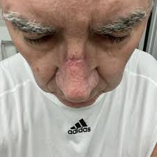 MILLIGAN DERMATOLOGY