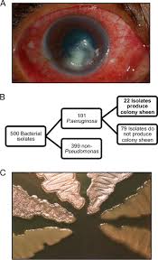 A species of considerable medical importance. Environmentally Endemic Pseudomonas Aeruginosa Strains With Mutations In Lasr Are Associated With Increased Disease Severity In Corneal Ulcers Msphere